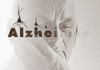 ۱۰ نشانه آلزایمر را به خاطر بسپارید