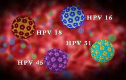 ویروس HPV را چقدر می شناسید؟