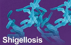 بیماری شیگلوز را می شناسید؟